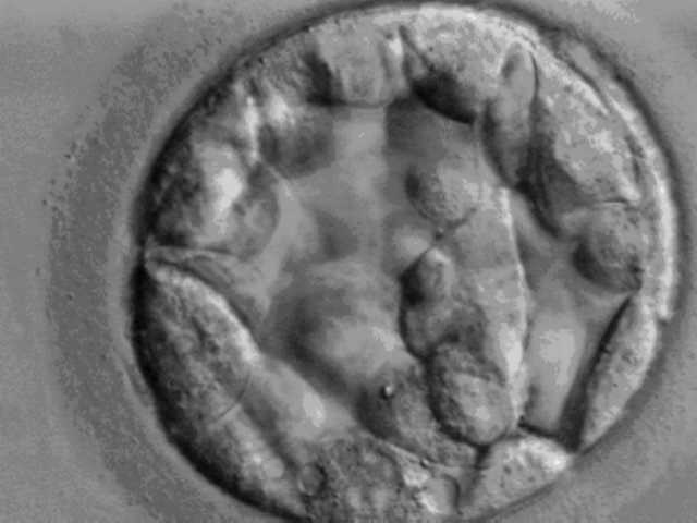 What to Expect During an IVF Cycle