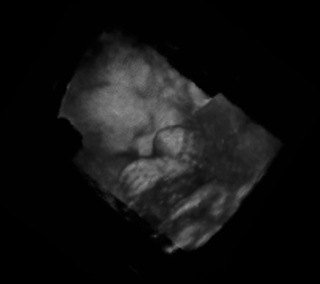 Fetal Medicine