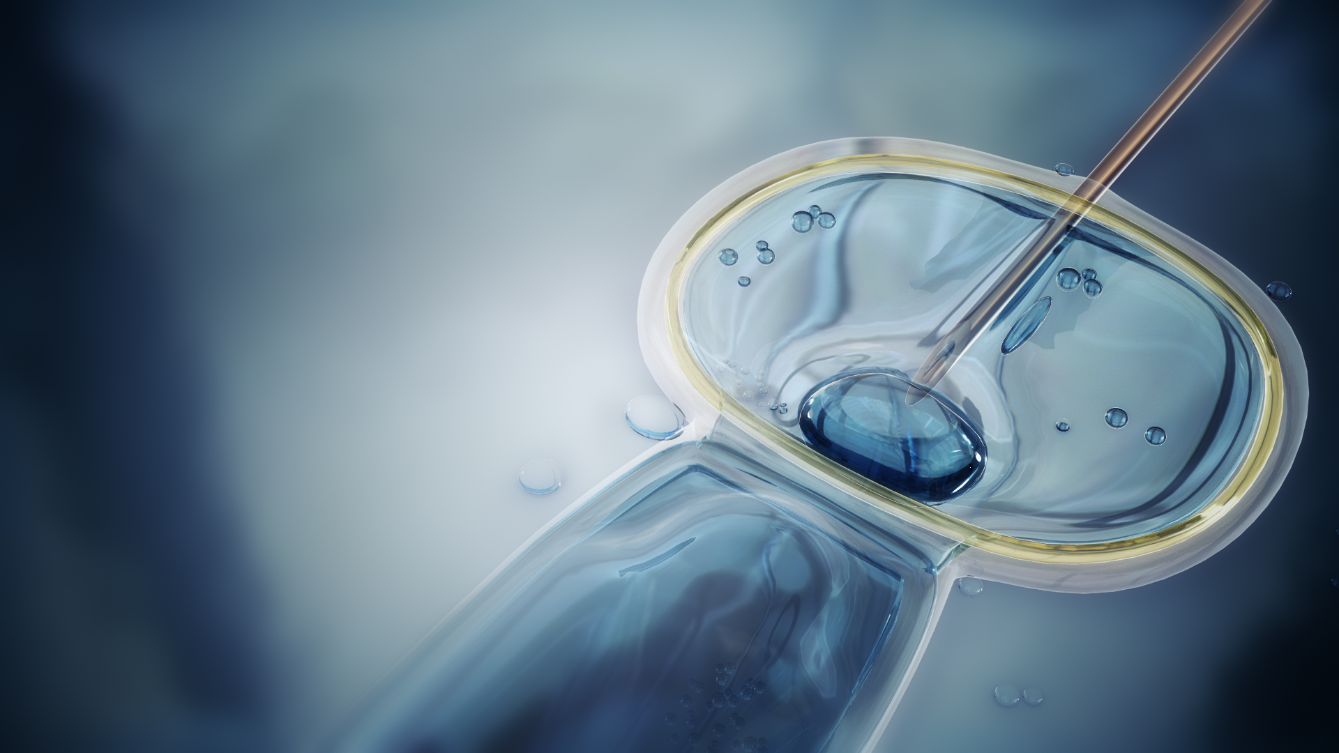 Intracytoplasmic Sperm Injection (ICSI)