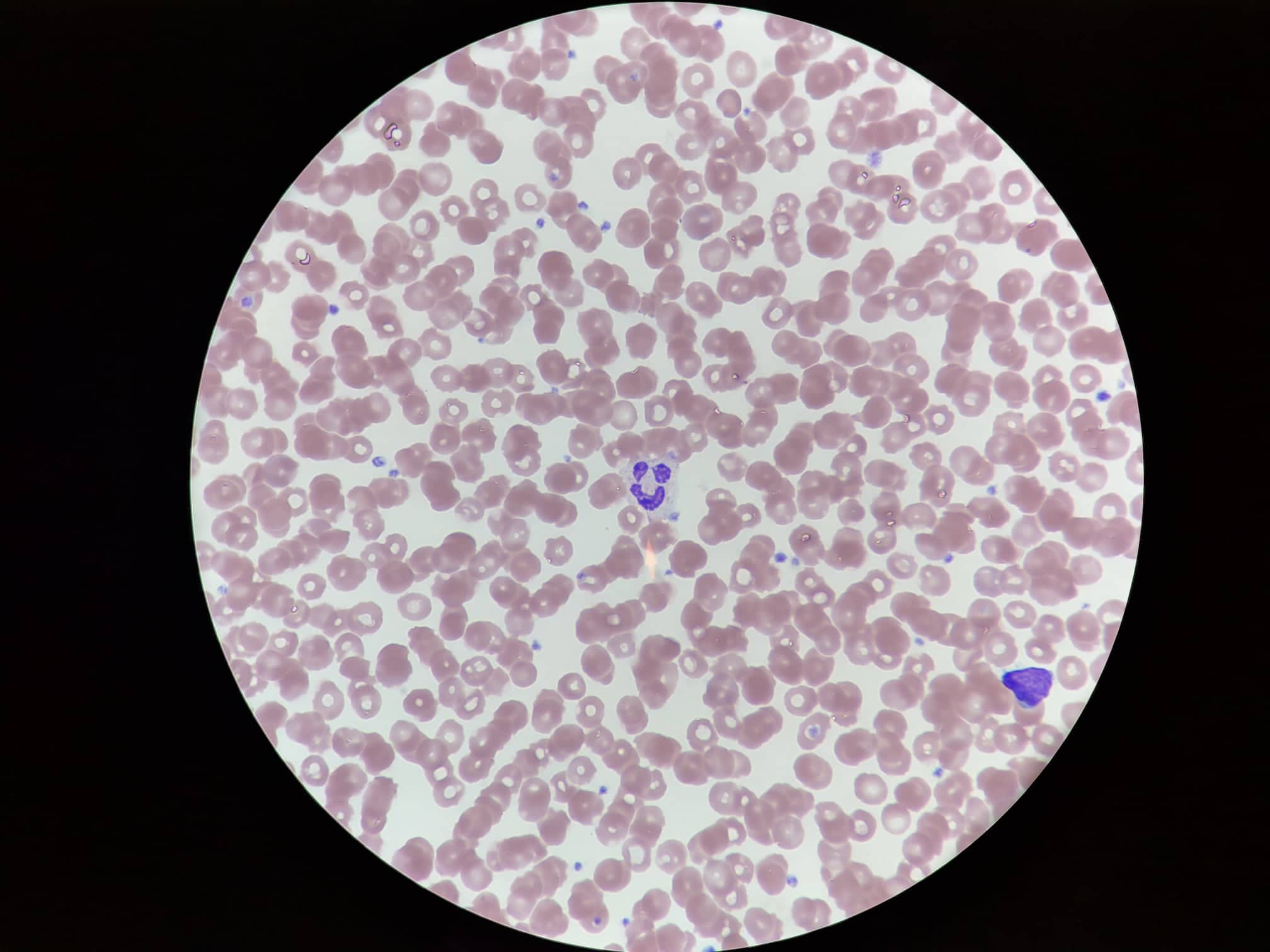 Pathology & Diagnostics