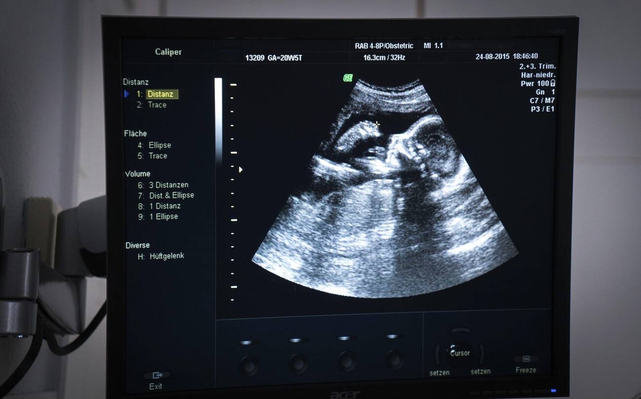 Understanding Your Fertility Window